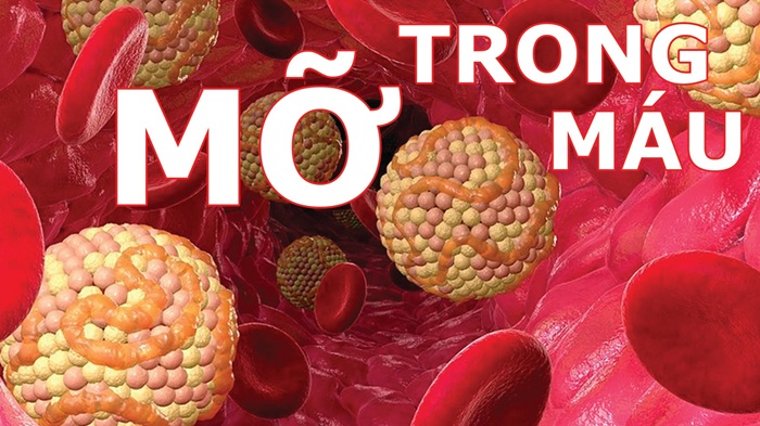 Motarin Hỗ Trợ Giảm Mỡ Máu, Ổn Định Huyết Áp Bằng Thảo Dược 4 chỉ số mỡ máu cao