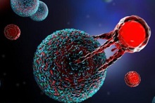 Bệnh viện Bình Dương Thành Công Phẫu Thuật Ghép Tay Cho Bà Mẹ Mang Thai