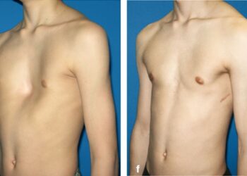 Bệnh Nhân Nguy Kịch Với Vết Thương Tim Được Cứu Sống Tại Bệnh Viện Đa Khoa Bình Dương