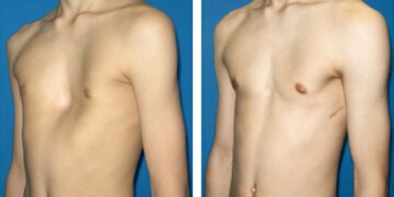 Bệnh Nhân Nguy Kịch Với Vết Thương Tim Được Cứu Sống Tại Bệnh Viện Đa Khoa Bình Dương